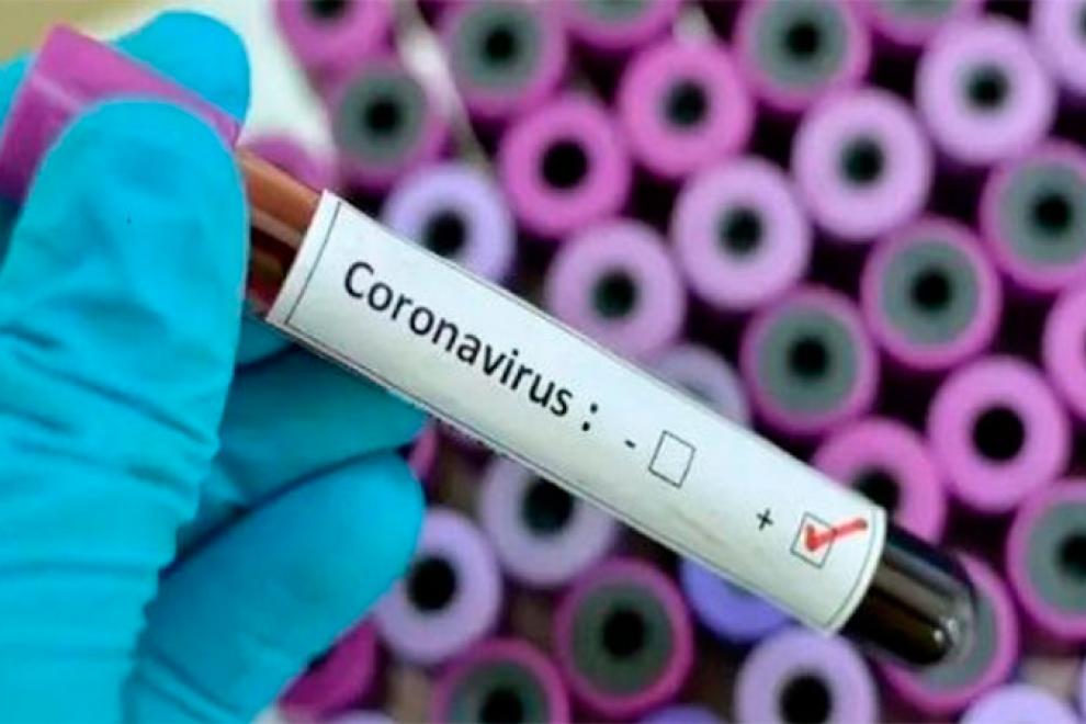 Coronavirus: el riesgo inmediato para la población argentina se considera bajo