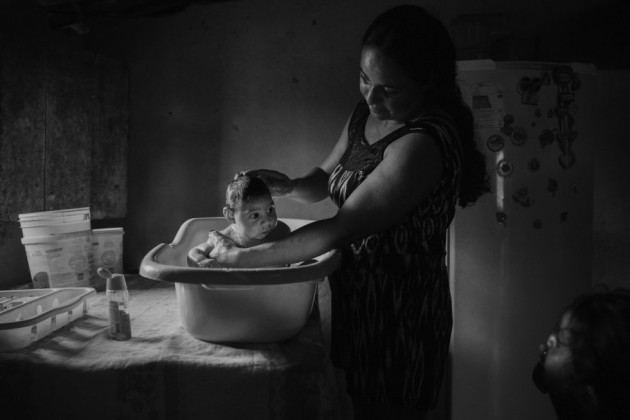 27- Fotografía tomada por el fotógrafo brasileño Lalo de Almeida, de Folhapress, que ganó el segundo premio de la categoría “Temas Contemporáneos”. La imagen, “Víctimas del virus Zika”, muestra a Adriana Cordeiro Soares, de 30 años, que baña a su hijo Joao Miguel, de 3 meses, en su casa en Sao Vicente do Serido (Brasil). En septiembre de 2015, comenzaron a nacer bebés en Brasil con microcefalia y otras malformaciones cuya relación con el virus Zika se confirmó en abril de 2016. Muchos niños con microcefalia viven a cientos de kilómetros del hospital más próximo y viajan durante horas para recibir atención médica.