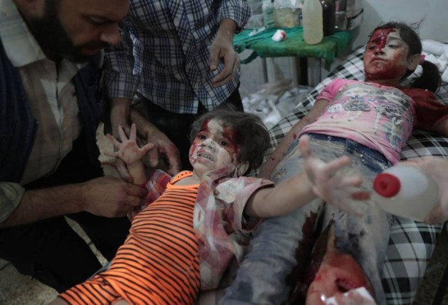 5- Imagen del fotógrafo Abd Doumany, de la Agencia France Presse (AFP), ganadora del segundo premio de la categoría “Noticias de Actualidad”. En la foto, una niña siria herida es atendida en un hospital tras un bombardeo en la ciudad de Duma.