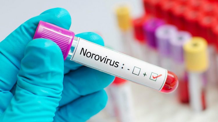 Emitieron un informe sobre casos de Norovirus registrados en Luján en septiembre