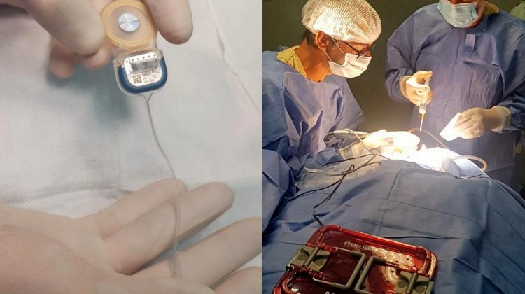 Dos jóvenes villamercedinos recibieron implantes que les permitirán recuperar la audición