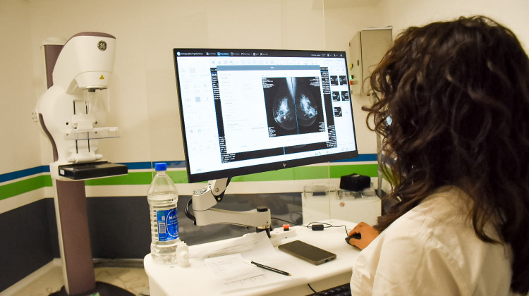 El Hospital “Verónica Bailone” ya cuenta con un mamógrafo de última generación