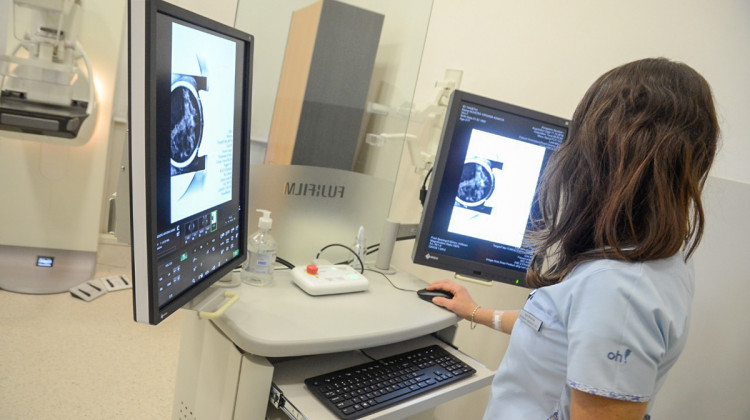 DOSEP lanza el Programa de Prevención de Cáncer de Mama y Cáncer de Cuello de Útero