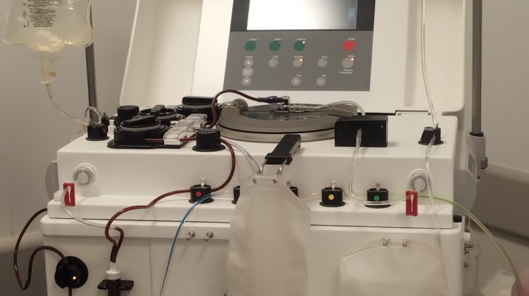 Plasmaféresis en el Hospital ‘Carrillo’: un tratamiento vital para pacientes críticos